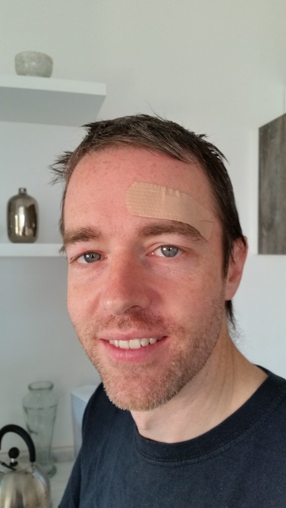 Pedr's looking a little worse for wear after getting into a fight with a lamppost.